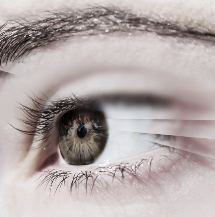 droopy eye lid treatment