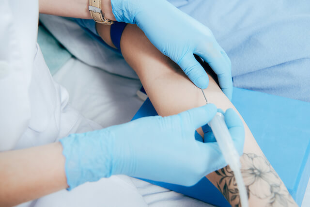 Best Tattoo Removal Laser In Singapore