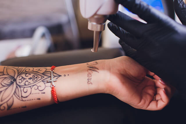 Pico Laser Tattoo Removal Cost Singapore, HIFU Treatment Cost