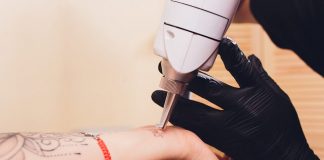 Best Tattoo Removal Laser Singapore, Best Tattoo Removal Singapore